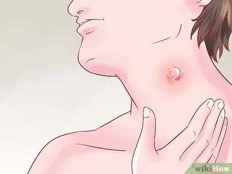 Image intitulée Recognize Boils Step 1