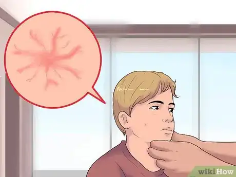 Image intitulée Know if You Have an Enlarged Liver Step 6