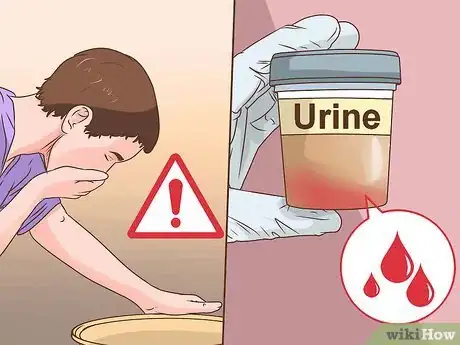 Image intitulée Know if You Have Kidney Stones Step 5