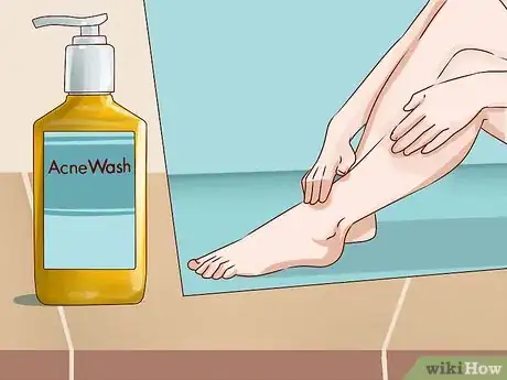 Image intitulée Get Rid of Leg Acne Step 7