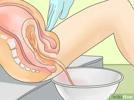 Image intitulée Deliver a Baby Step 19