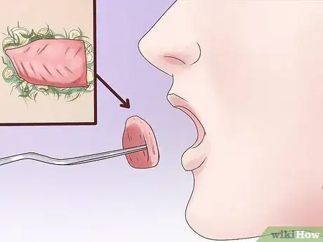 Image intitulée Dissolve Kidney Stones Step 5