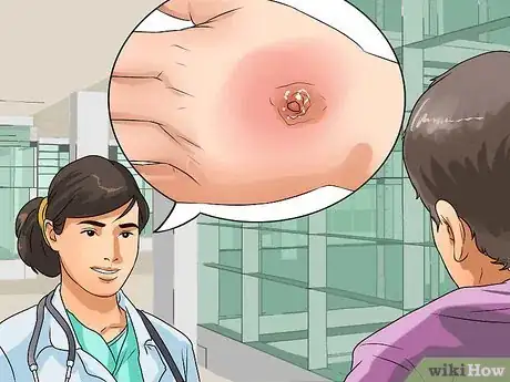 Image intitulée Cure Boils Naturally Step 12