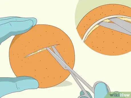 Image intitulée Practice Surgery Skills on Fruit Step 2