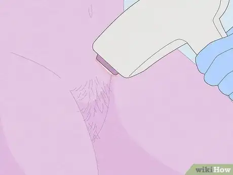 Image intitulée Deal With Pubic Hair Step 6