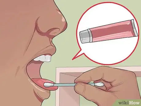 Image intitulée Treat Tongue Burn Blisters Step 11