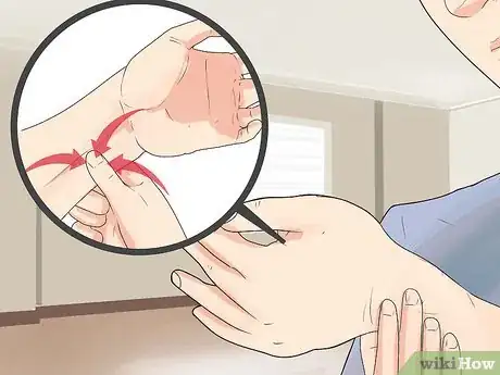 Image intitulée Tell if You Have Water Retention Step 7