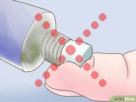 Image intitulée Clean Your Nose Piercing Step 8