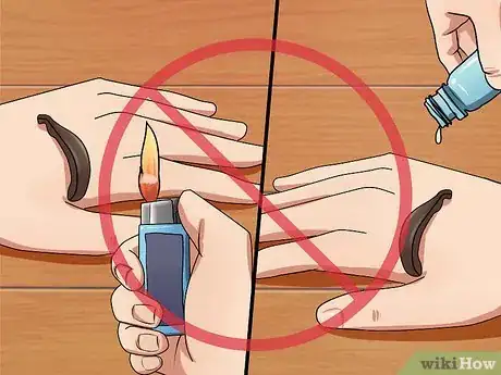 Image intitulée Kill Leeches Step 6