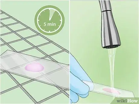 Image intitulée Identify Bacteria Step 17