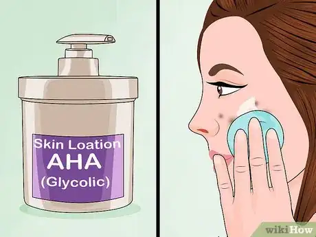 Image intitulée Apply a TCA Peel Step 2