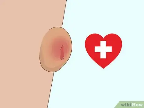 Image intitulée Stop Warts from Bleeding Step 5
