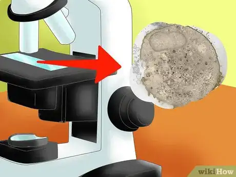 Image intitulée Tell the Difference Between Prokaryotes and Eukaryotes Step 5