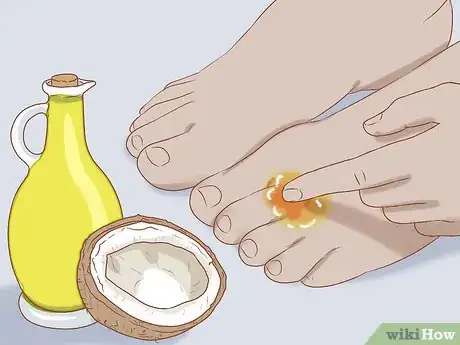 Image intitulée Treat a Skin Fungal Infection Step 11