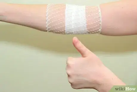 Image intitulée Strap an Elbow Step 13