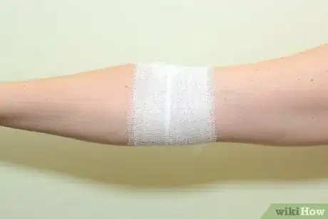 Image intitulée Strap an Elbow Step 11