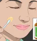 enlever les grains de beauté sans chirurgie