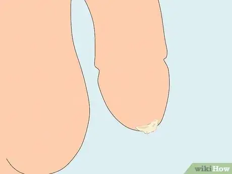 Image intitulée Treat Pain and Swelling in the Testicles Step 8