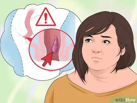 Image intitulée Tell if You Have Internal Hemorrhoids Step 3