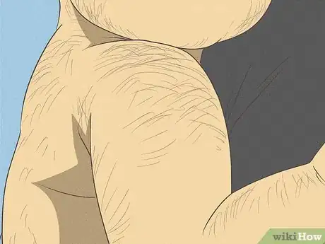 Image intitulée Know What to Expect on a Newborn's Skin Step 9