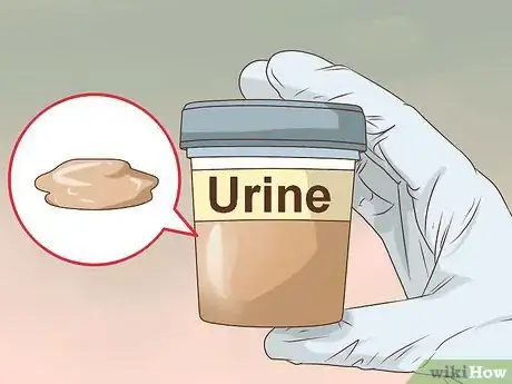 Image intitulée Know if You Have Kidney Stones Step 2