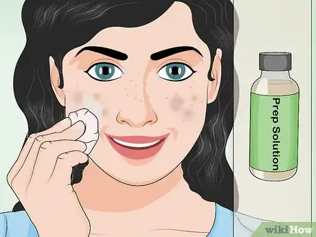 Image intitulée Apply a TCA Peel Step 7