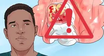 retirer les aliments coincés dans les trous d'extraction de dents de sagesse