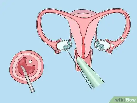 Image intitulée Raise the Chances of Having a Boy Step 10