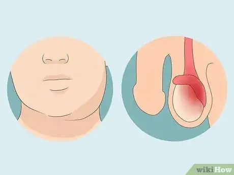 Image intitulée Treat Pain and Swelling in the Testicles Step 9