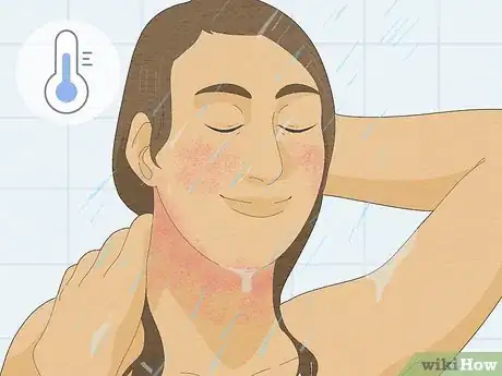 Image intitulée Treat Heat Rash Step 5