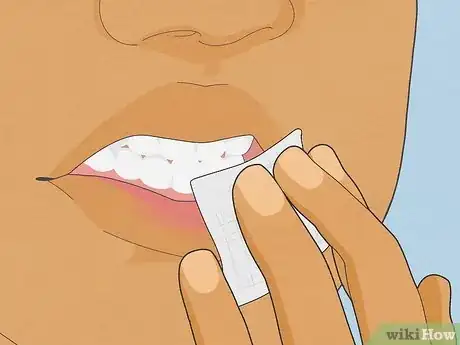 Image intitulée Treat a Cut Lip Step 8