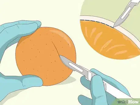 Image intitulée Practice Surgery Skills on Fruit Step 1