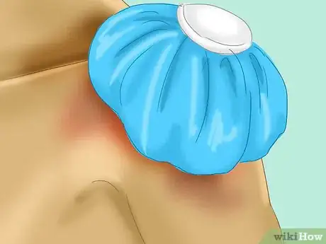 Image intitulée Fix Shoulder Pain for Athletes Step 2