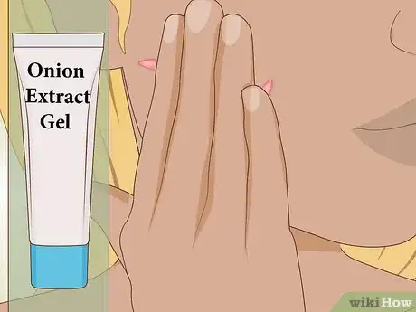 Image intitulée Get Rid of Keloids Step 11