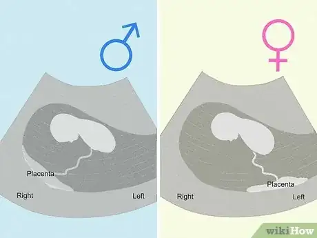 Image intitulée Tell if You're Pregnant with a Girl or Boy Step 26
