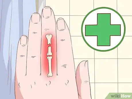 Image intitulée Deal With the Pain of a Door Being Shut on Your Finger Step 12