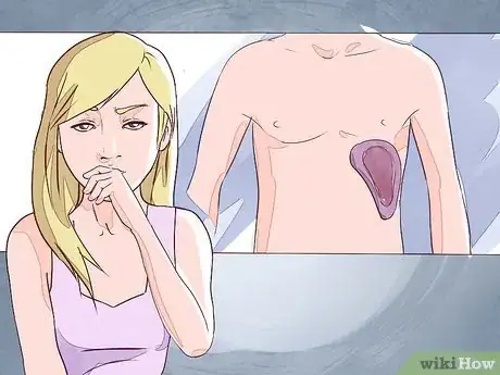 Image intitulée Differentiate Between Malaria, Dengue, and Chikungunya Step 3