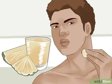 Image intitulée Get Rid of Skin Tags Step 17