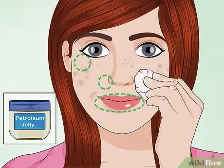 Image intitulée Apply a TCA Peel Step 8