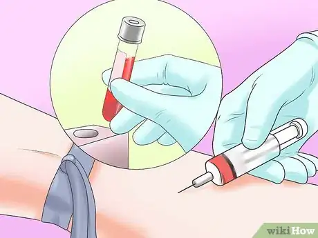 Image intitulée Lower CRP (C‐Reactive Protein) Step 14