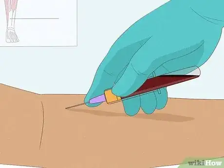 Image intitulée Get Rid of a Rash Between Your Legs Step 20