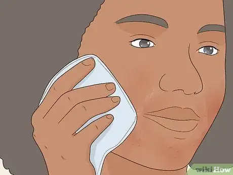 Image intitulée Heal over Exfoliated Skin Step 6