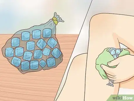 Image intitulée Get Rid of Shin Splints Step 9