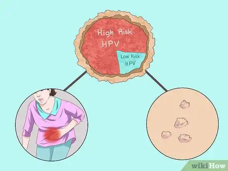 Image intitulée Recognize HPV in Women (Human Papillomavirus) Step 5