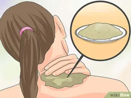 Image intitulée Naturally Stop Granuloma Annulare Step 12