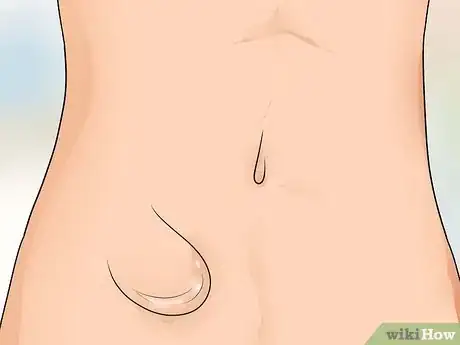 Image intitulée Know if You Have a Hernia Step 16