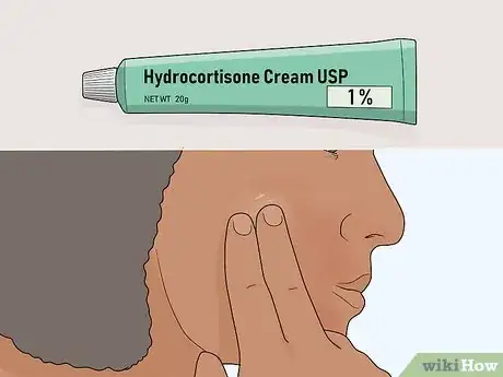 Image intitulée Heal over Exfoliated Skin Step 8