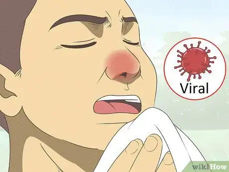 Image intitulée Differentiate Bacterial Tonsillitis and Viral Tonsillitis Step 1