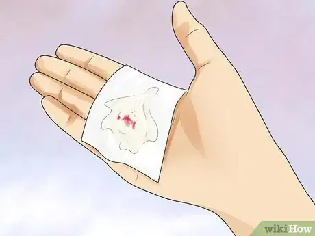 Image intitulée Know if You Have Prostate Cancer Step 8