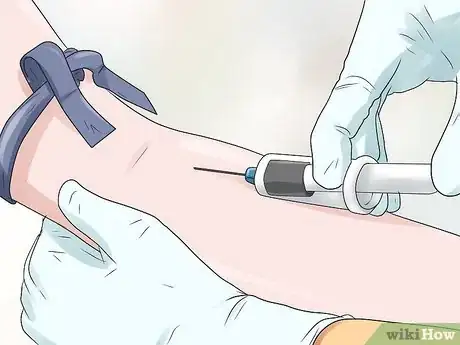 Image intitulée Calculate Anion Gap Step 10
